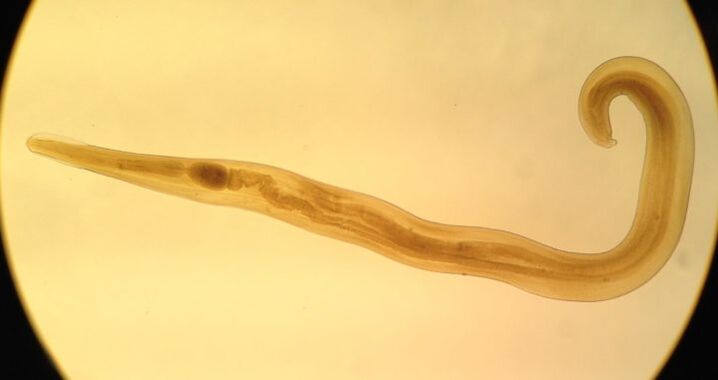 Os oxiuros son un tipo común de parasitos redondos que causan enterobiase.